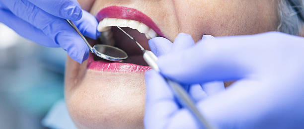 Best Emergency Wisdom Tooth Extraction in Inverness Highlands North, FL